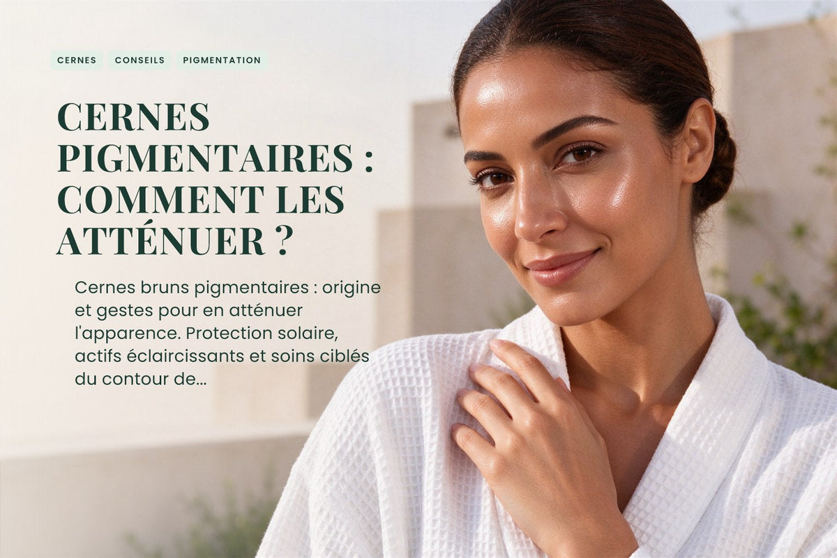 Cernes pigmentaires : comment les atténuer ?