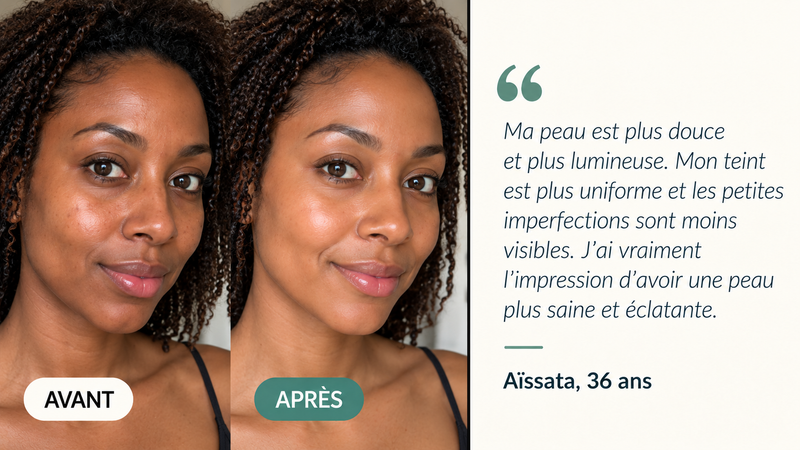 Témoignage avant/après — Masque Bio Collagène